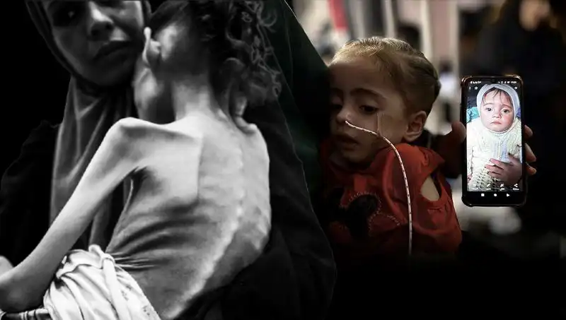 Küçük Meryem’in Açlıkla Mücadelesi: 25 Kilodan 10 Kiloya Düşen Bir Hayat