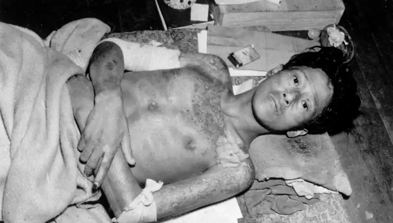 80 Yıl Sonra Nagasaki'den Acil Uyarı: Nükleer Tehdit Artıyor
